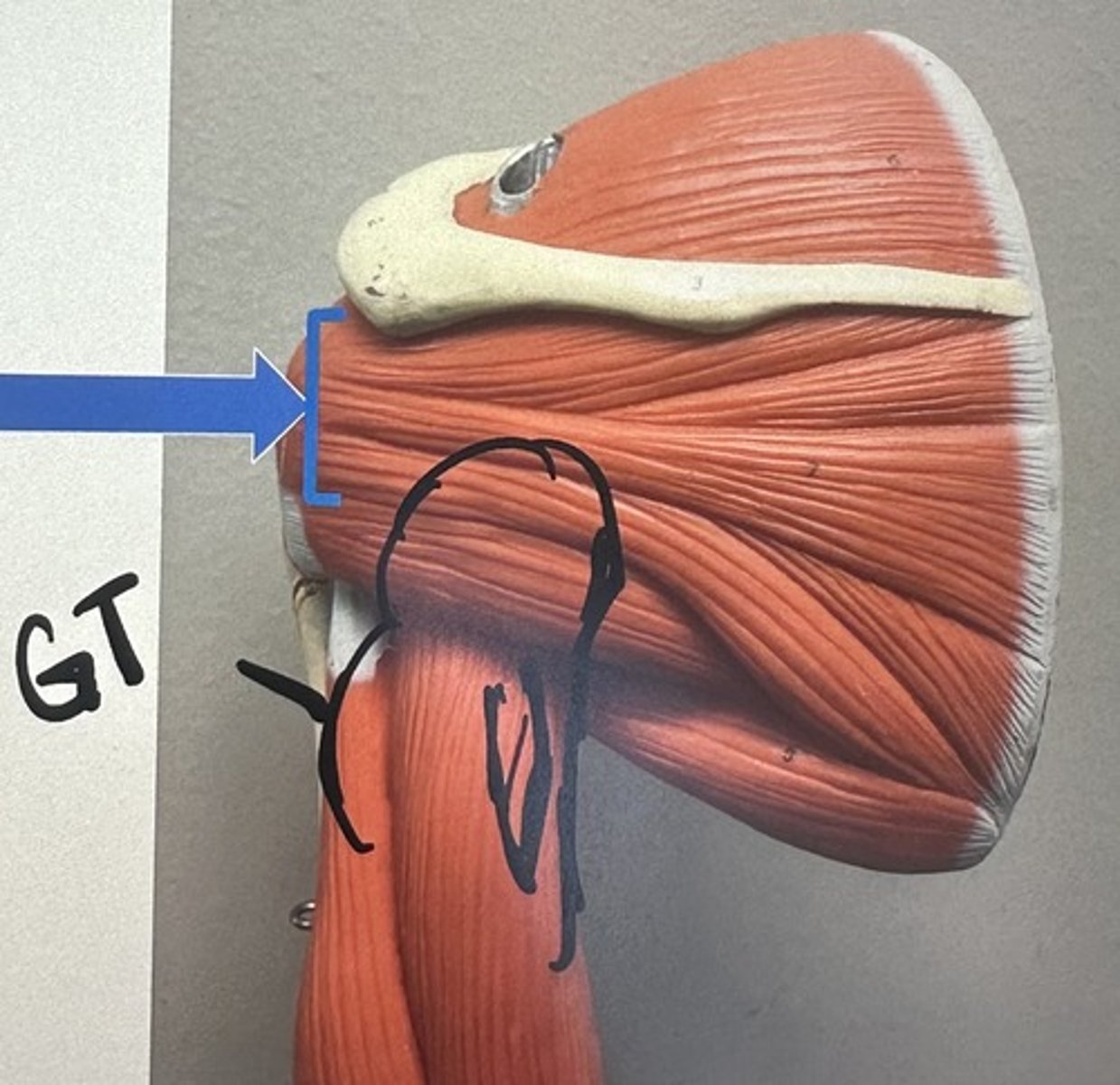 <p>What are the (2) attachments of the Infraspinatus?</p>