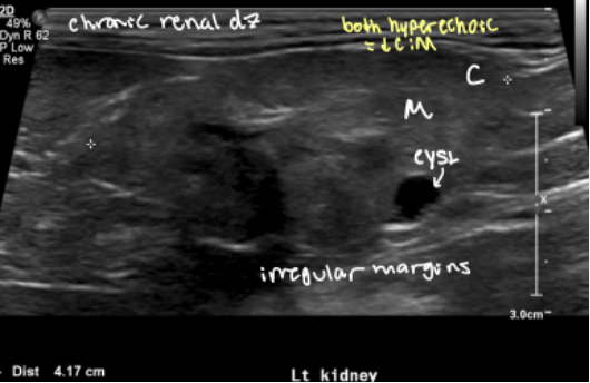 <ul><li><p>chronic renal disease</p></li><li><p>renal dysplasia</p></li></ul><p></p>
