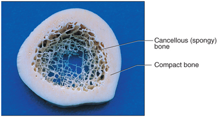 <p>a living connective tissue with two types:</p><ul><li><p>Cancellous (spongy) bone</p></li><li><p>Compact bone</p></li></ul><p></p>