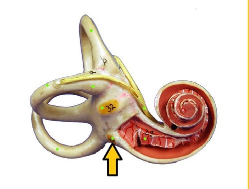 Membrane-convered opening in bone surrounding cochlea that releases sound vibrations from the cochlea