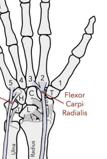 <p>The muscle has an insertion on the anterior side of the proximal base of the 2nd &amp; 3rd MC</p><p>-flexion and abduction</p>