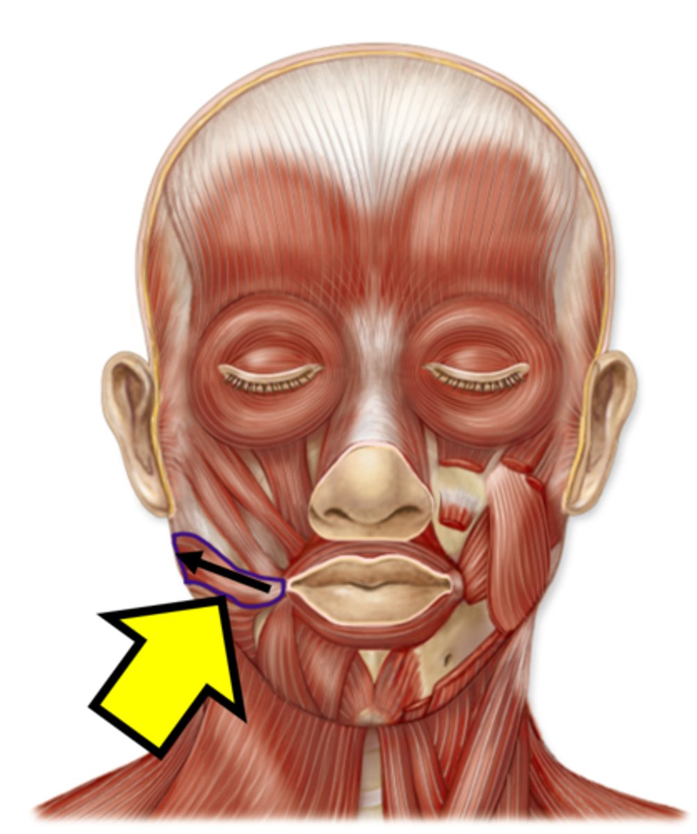 <p>Name the muscle.</p>