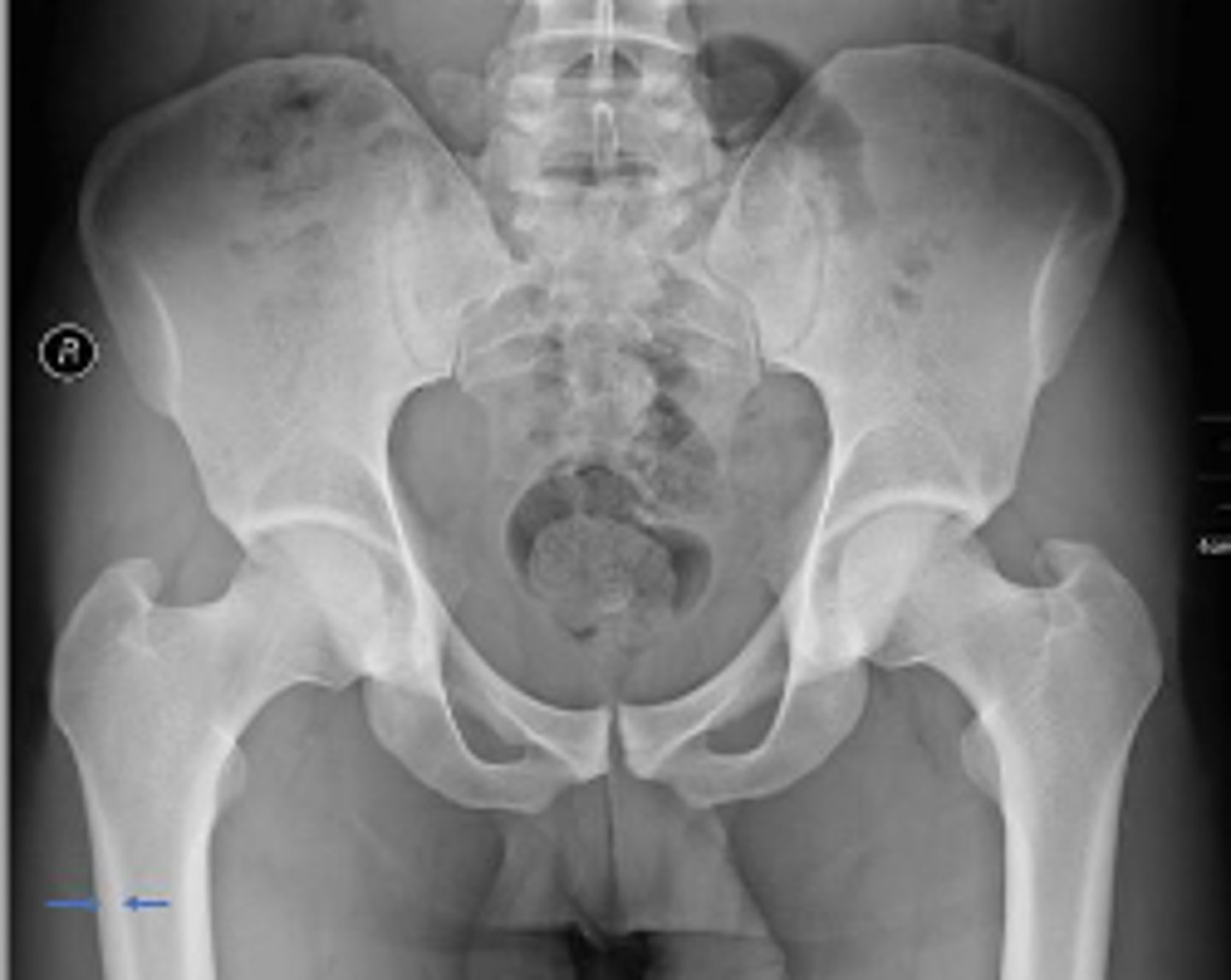 <p>What are the arrows pointing to?</p>