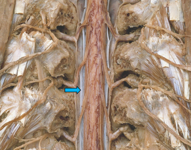 <p>What is the blue arrow pointing to?</p>