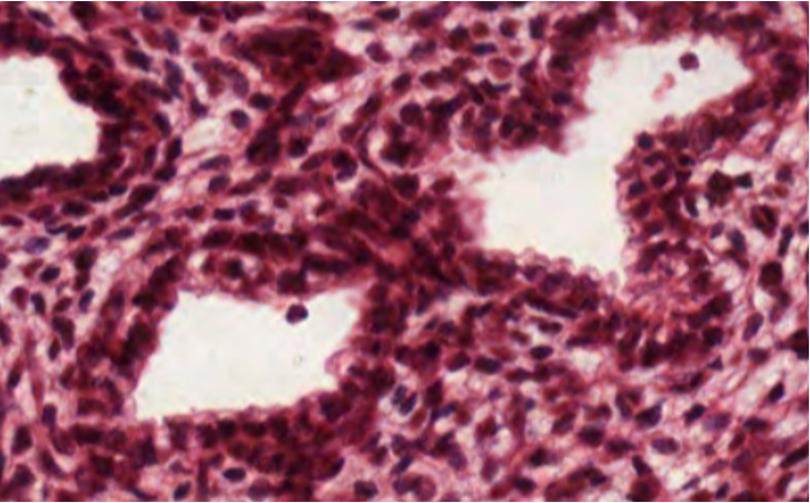 <p>Terminally differentiated monocytes that are strongly phagocytic and essential for tissue health and immune responses. Localised in tissues, but are not the same across organs. Other roles:</p><ul><li><p>Iron metabolism</p></li><li><p>Wound repair</p></li><li><p>Tissue growth</p></li></ul><p></p>