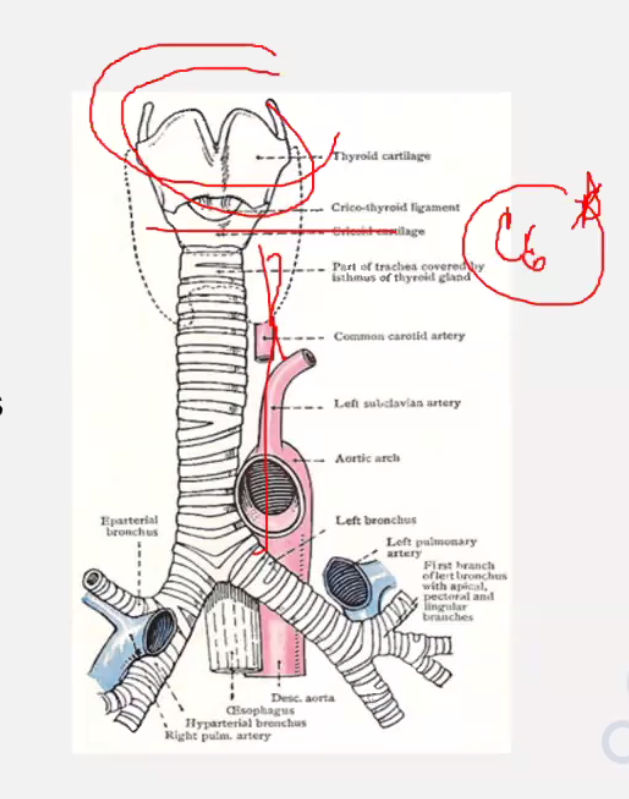<p>Made of U shaped cartilaginous bars of hyaline </p><p>Posterior is free</p>