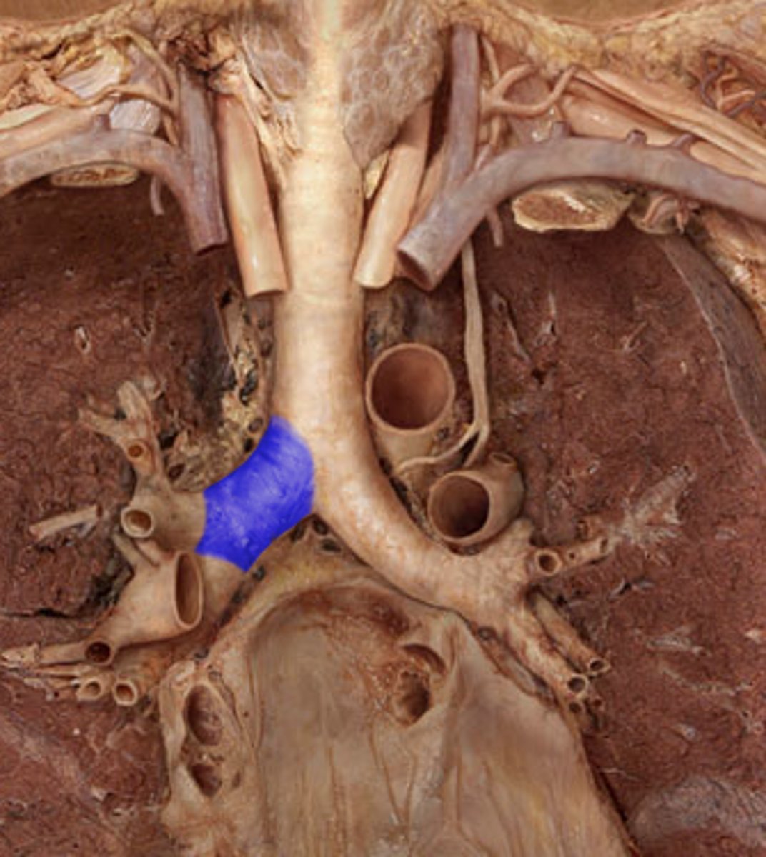 <p>a pair of branches of the trachea that lead to the right and left lung; consist of incomplete rings of cartilage and are lined by pseudostratified ciliated columnar epithelium</p>