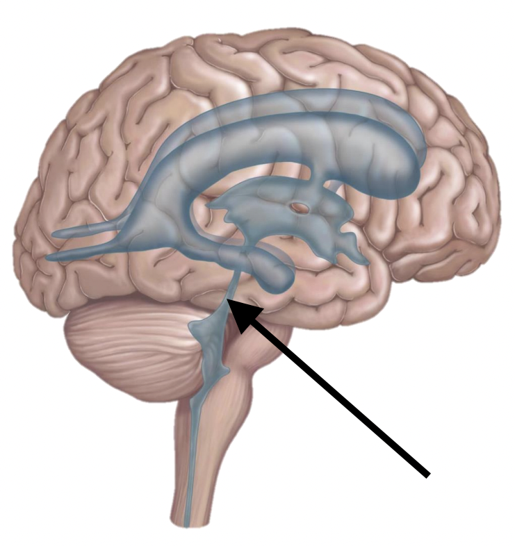 <p>Name the structure</p>