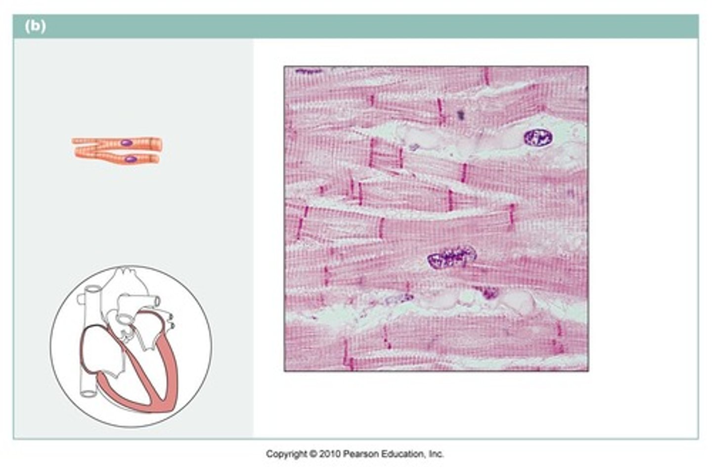 <p>name the type of muscle tissue</p>