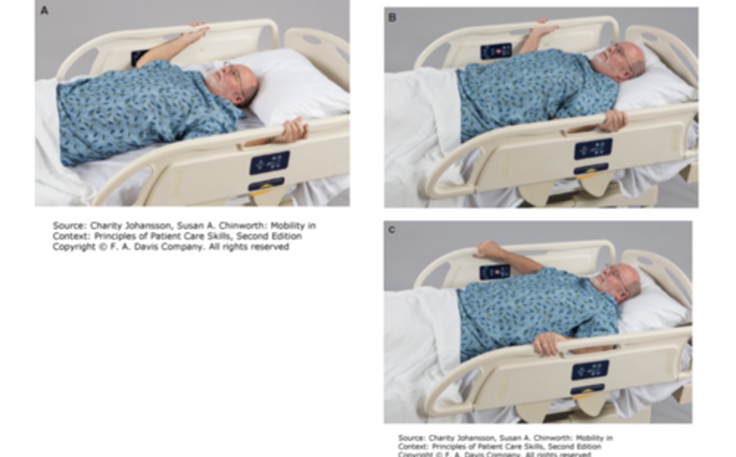 <p>(A) The patient grasps the bed rails at or above the level of the head. The underhand grip provides more initial pulling power.</p><p>(B) Lifting the head slightly, the patient uses both arms to pull the body up toward the head of the bed.</p><p>(C) To complete the upward shift, the patient repositions the hands on top of the handrail to achieve a final push.</p>