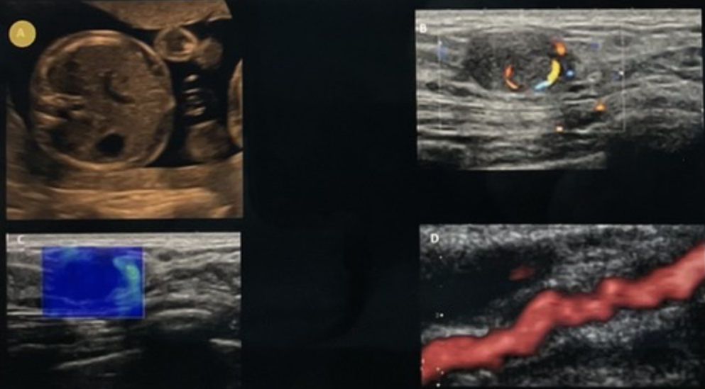 <p>Which of the following imaging techniques is designed to improve contrast resolution?</p><p>a. top left<br>b. top right <br>c. bottom left <br>d.bottom right</p>