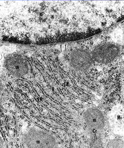 <p>morphology</p><ul><li><p>membrane bound cysternae <strong>10 nm wide</strong></p></li><li><p>ribosomes on outer</p></li><li><p>linked to nuclear membrane</p></li><li><p>stained with basic dye <strong>basophilia </strong>becaus eof ribosomes/RNA</p></li></ul><p>localisation</p><ul><li><p>in basic part, as nissl granulation in the neurons</p></li></ul><p></p>