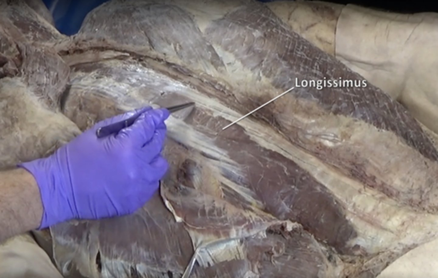 <p>Middle muscle of the erector spinae group.</p>