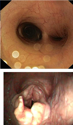 <ul><li><p>Polyphonic wheeze</p></li><li><p>Monophonic wheeze- single sound (in image)</p></li></ul><p></p>