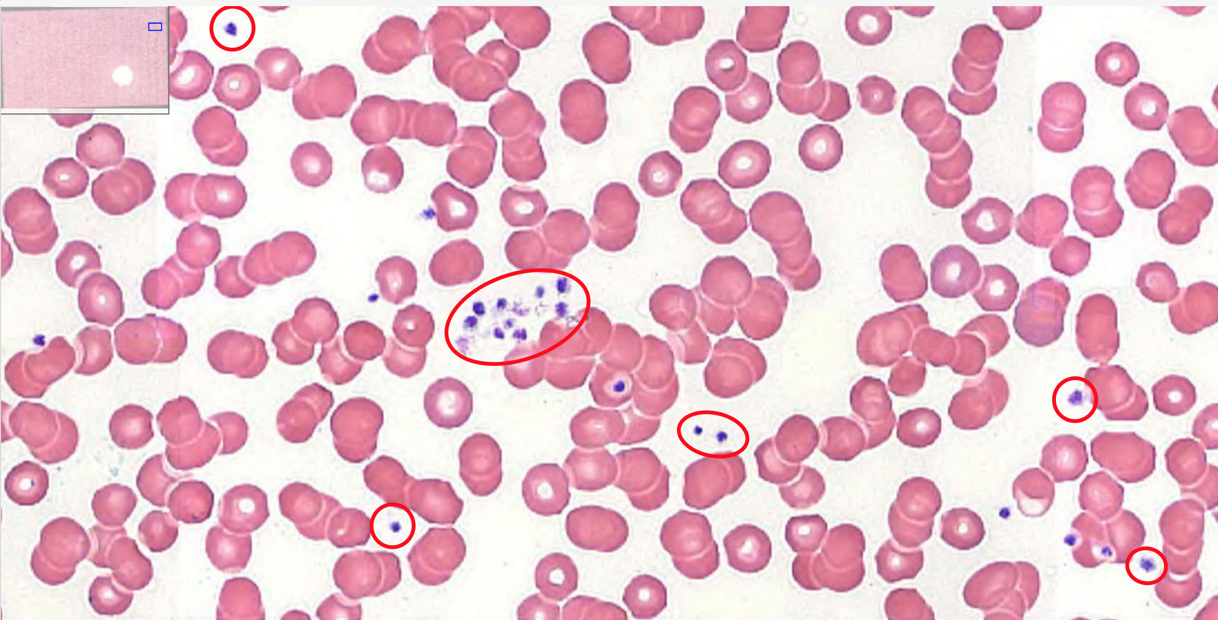 <p>Thrombocyte</p>