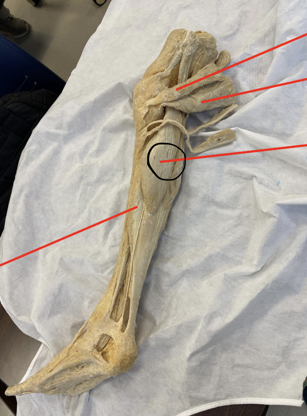 <p>identify + state origin, insertion, action, innervation of marked structure</p>