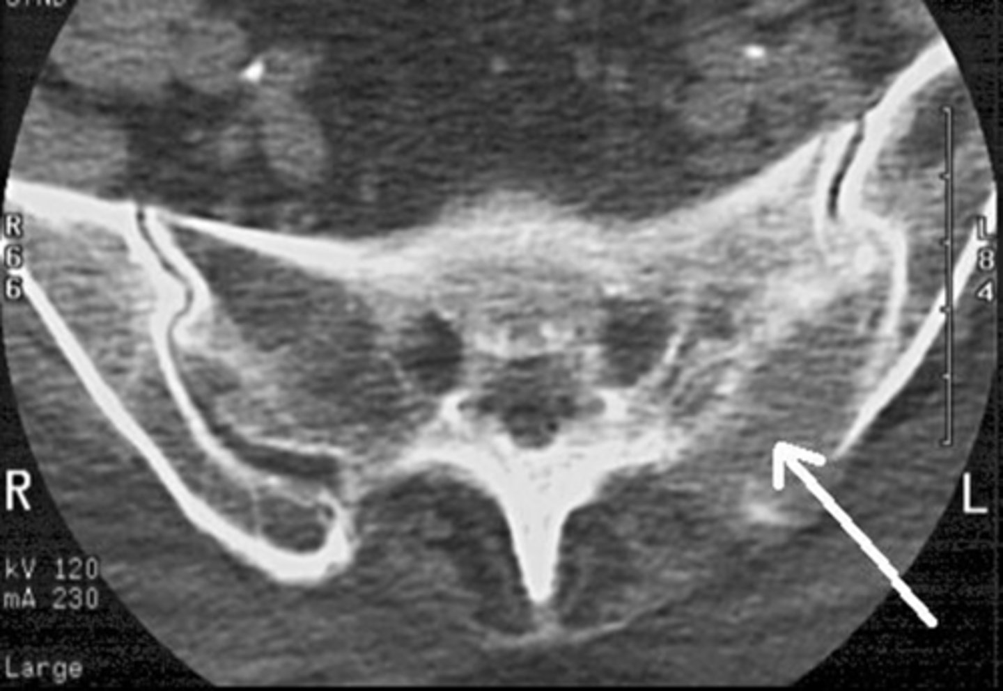 <p>Where is this pathology located (2)</p>