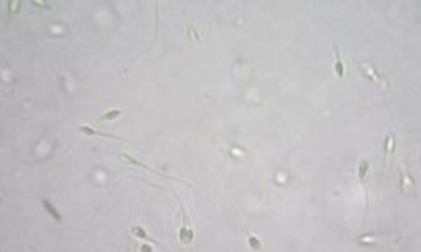 <p>- Seen in intact males</p><p>- Have head and tail</p><p>- Die in fridge</p>