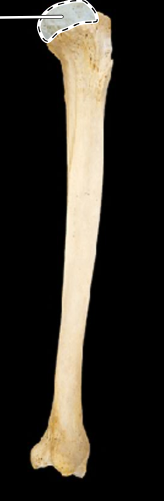 <p>Tibia, lateral view, right side</p>
