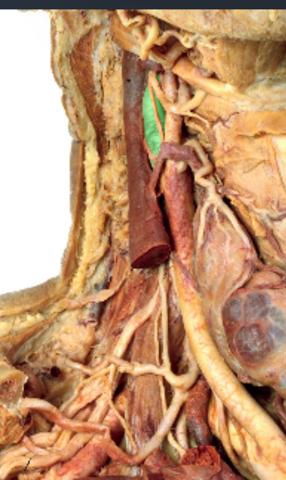 <p>Which artery?</p>