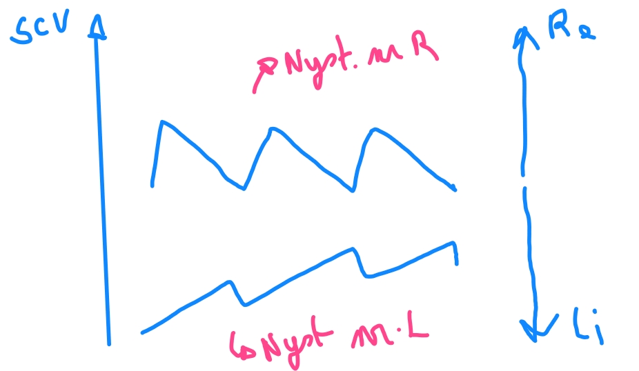 <ul><li><p>1ste graad nystagmus </p><ul><li><p>Enkel bij blik in de richting van de snelle <br>nystagmusfase → of harder</p></li></ul></li><li><p>2de graad nystagmus </p><ul><li><p>In centrale positie en bij blik in de richting <br>van de snelle nystagmusfase</p></li></ul></li><li><p>3de graad nystagmus </p><ul><li><p>Bij centrale blik en in beide blikrichtingen</p></li></ul></li></ul><p>bij cereprale compensate ga je door de 3 fasen</p><p>opletten plaatsen in patient voor L en R heé!! → nyst benoemen adhv&nbsp;zijn snelle fase</p><p></p>