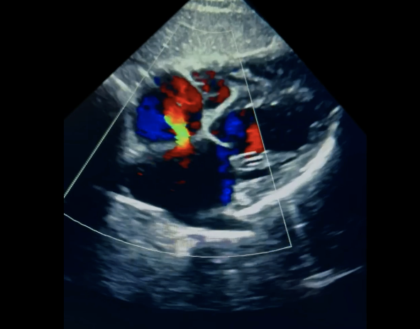 <p>Name the ASD demonstrated </p>