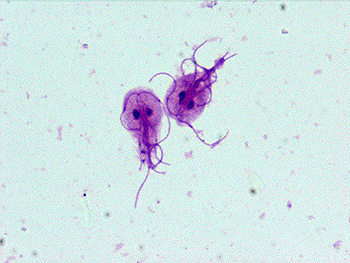 <p>What are some protozoa that can cause diarrhea? </p>