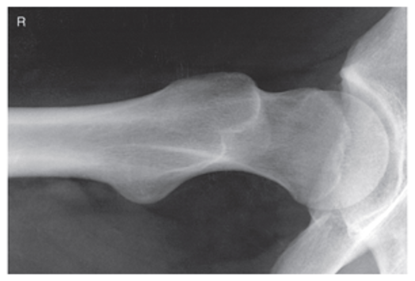 <p>- CR 30° to 40° mediolateral and 15° to 20° posteriorly from horizontal</p><p>- CR centered to femoral neck</p><p>- Entire femoral head, neck, and trochanters centered to IR</p><p>- Femoral head and neck in profile</p>