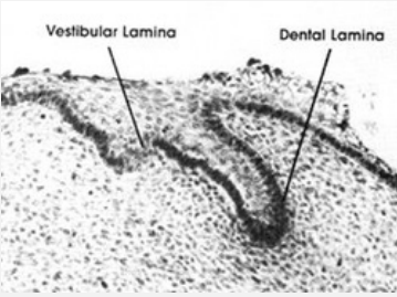<p><strong><span style="font-family: Times New Roman, serif">The two major features are the dental lamina and the vestibular lamina. The dental lamina forms the teeth. The vestibular lamina forms the external opening to the oral cavity.</span></strong></p>