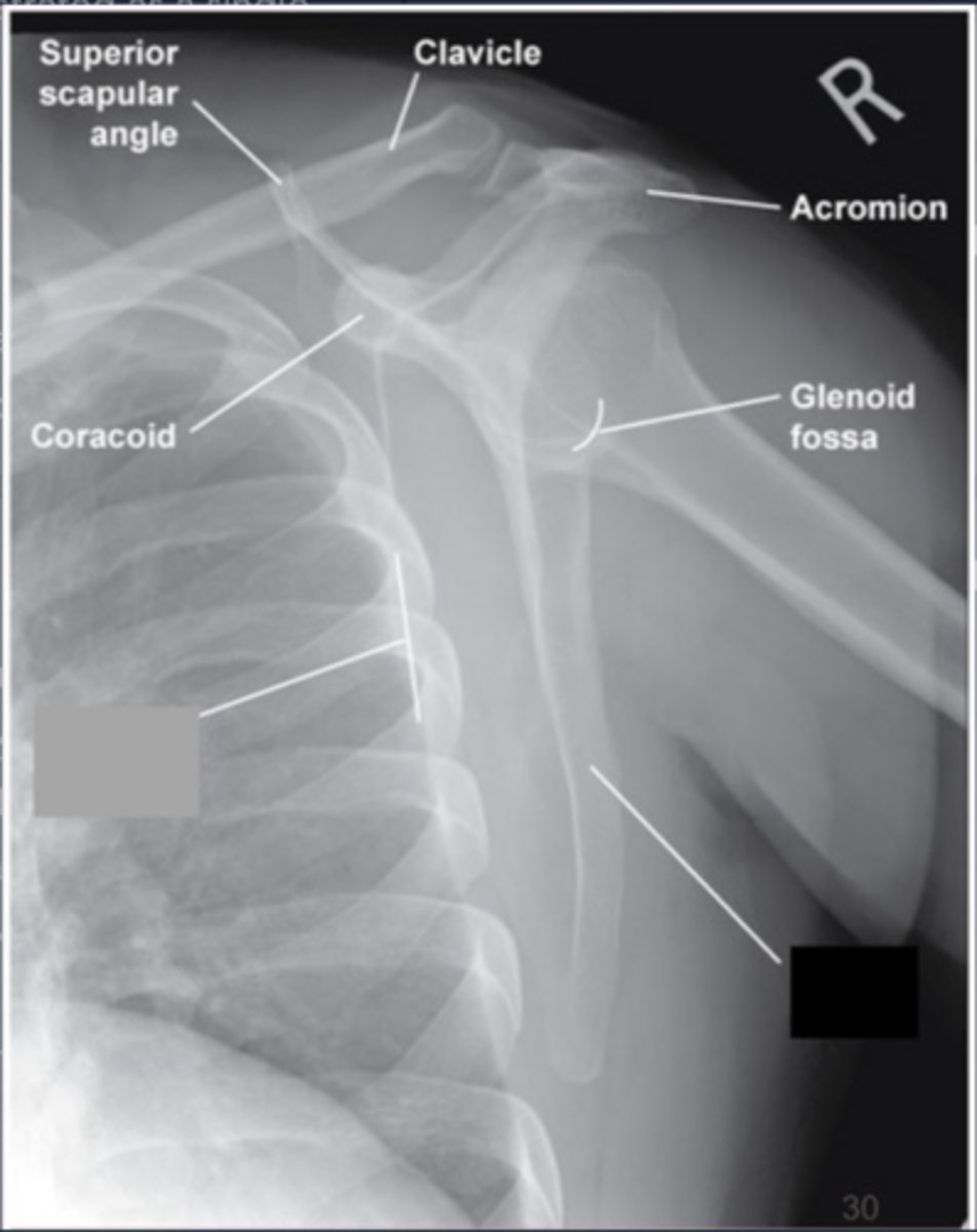 <p>Under rotated</p>