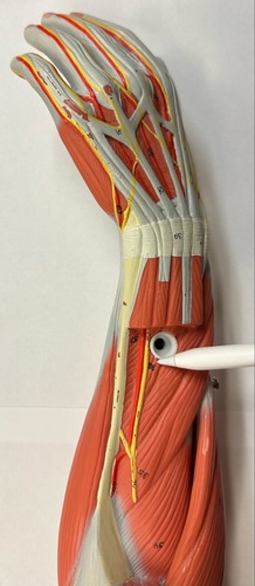 <p>What are the (2) attachments of the Extensor Pollicis Longus?</p>