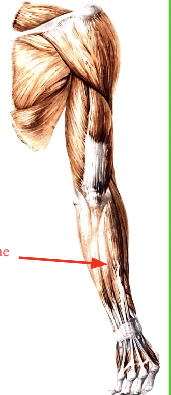 <p>what is this an posterior view of</p>