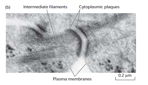 <p>Electron micrograph of a thin section of a desmosome</p>