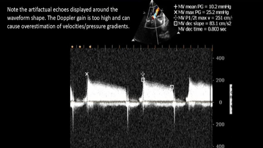 <p>How can a sonographer correct for blossoming on a spectral Doppler display? </p>