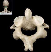 second cervical vertebrae