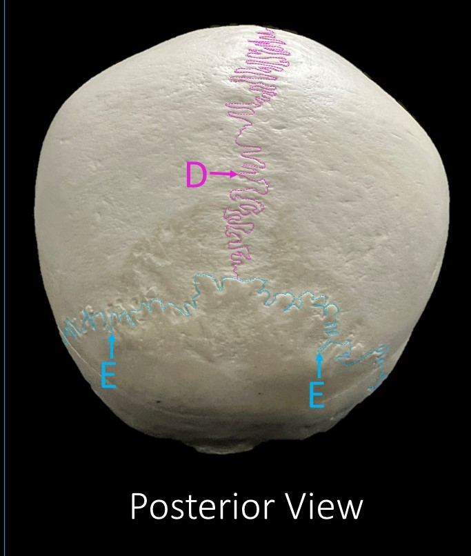 <p>Identify the structure labeled E. </p>