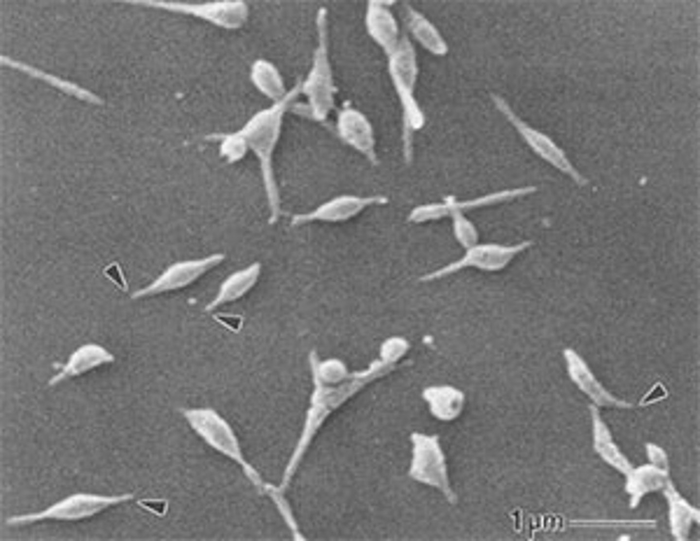 <p>-gram (-)</p><p>-small &amp; pleomorphic</p><p>-facultative anaerobic</p><p>-<strong>no cell wall</strong></p><p>-sterols in cell membrane</p><p>-transmission via aerosols from infection persons and asymptomatic carriers</p><p>-no target for β-lactams → but responds to macrolides, tetracyclines, and quinolones</p>
