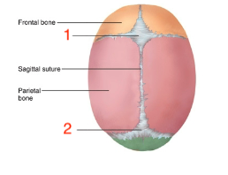 <p>what is #2</p>