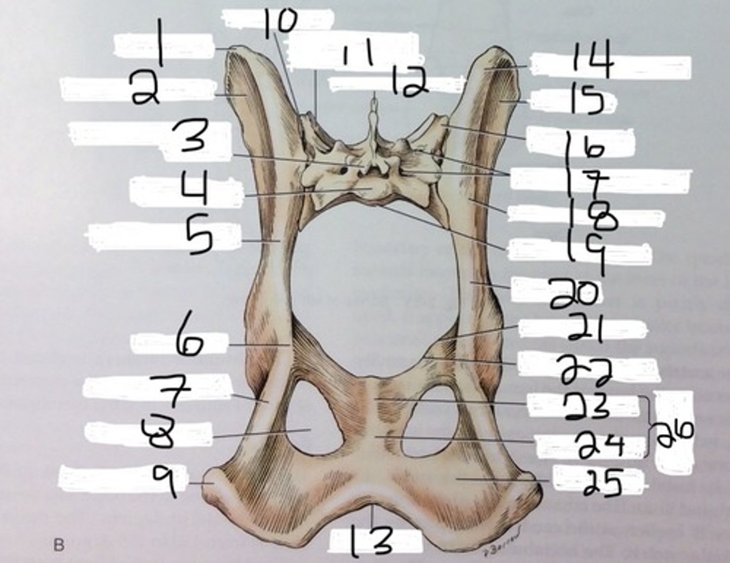 <p>two large holes on either side of the pelvic symphysis that help reduce the weight of the pelvis bones</p>