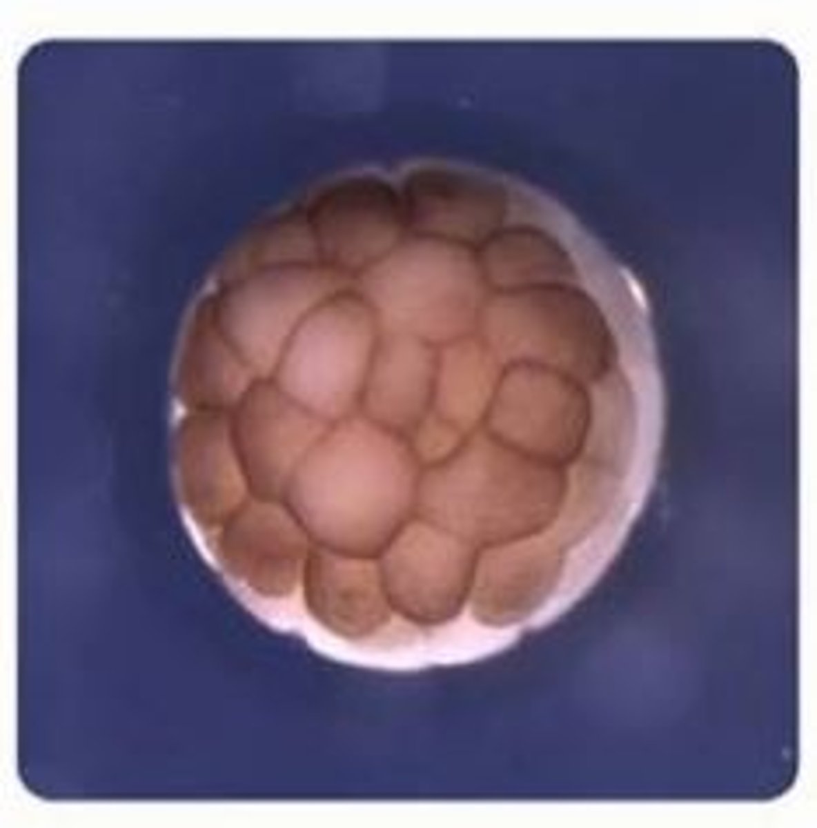 <p>A small ball of cells produced after fertilization that contains specialized cell called stem cells that can differentiate into all the cells in your body</p>