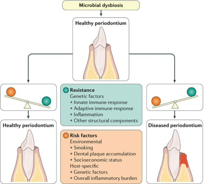 <ul><li><p>Inflammation drives selection of obligate anaerobes</p></li><li><p>Inflammation is an important source of nutrient:</p><ul><li><p>Degraded collagen and heme containing products, used by proteolytic &amp; asaccharolytic bacteria</p></li><li><p>GCF: rich serum exudate</p></li></ul></li><li><p>Inflammophilic bacteria or pathobionts have a survival advantage</p></li><li><p>resistance factors</p><ul><li><p>specifics in pic</p></li></ul></li><li><p>Risk factors </p><ul><li><p>specifics in pic</p></li></ul></li></ul><p>*LOOK AT PICTURE</p>
