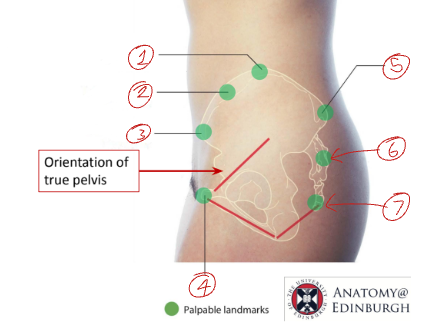<p>Name these palpable landmarks on the pelvis.</p>