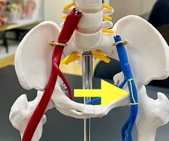 <p>Name the blood vessel.</p>