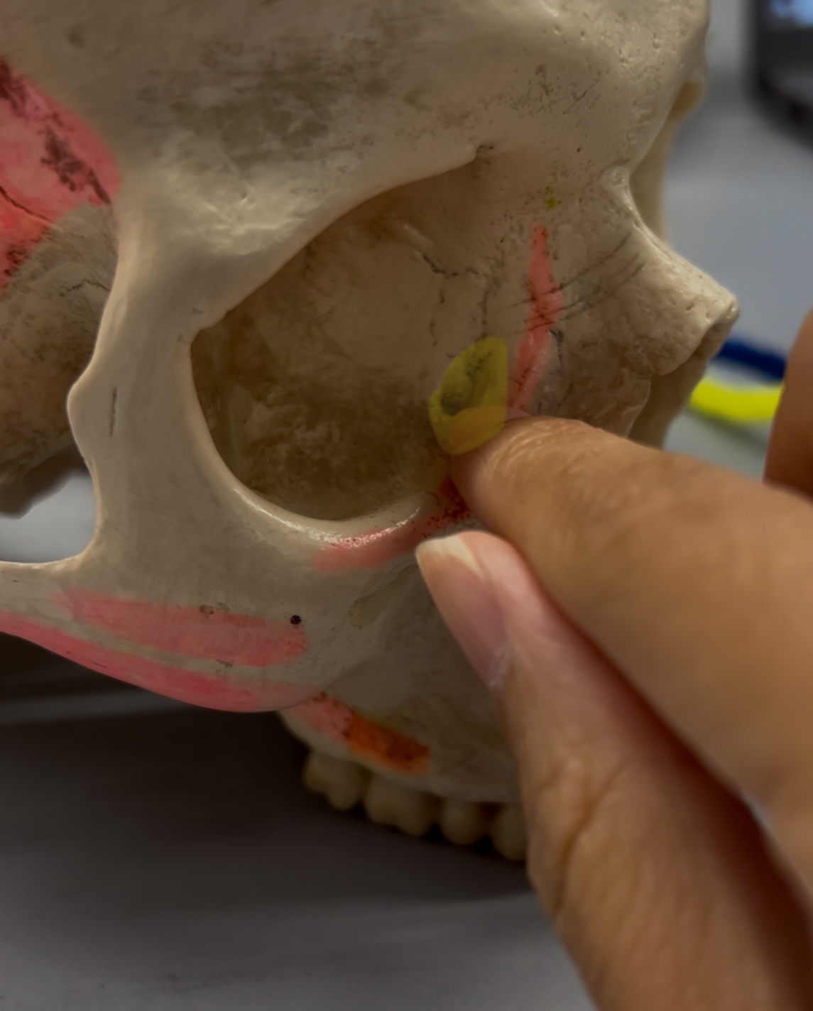 <p>What foramina is labeled by the yellow highlight? What bones are the located? Also, which if any cranial nerves pass through there?</p>
