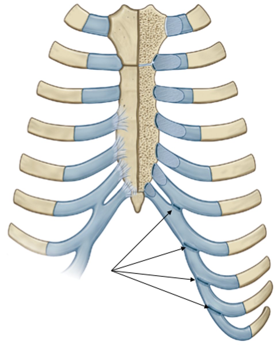 <p>- Joint between adjacent costal cartilages of ribs 6-10.</p><p>- Synovial plane joint.</p>
