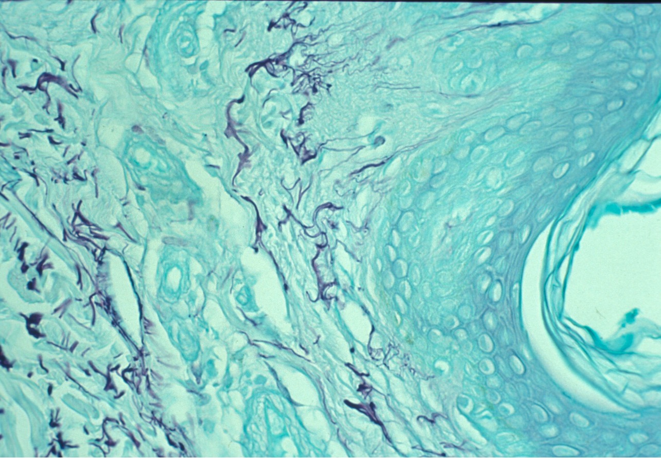 term image