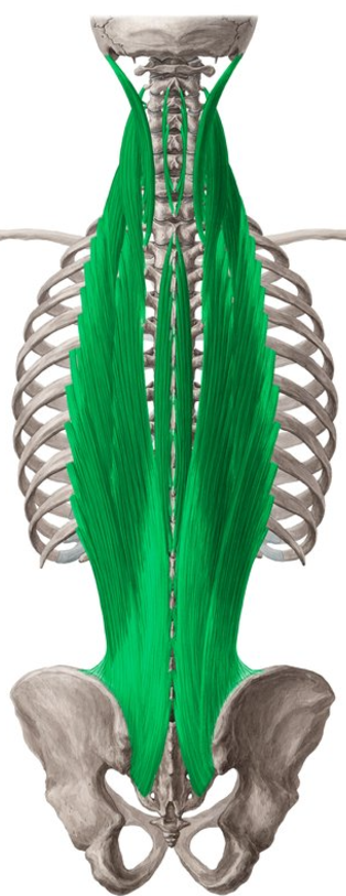 <p>Erector spinae action</p>