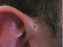 <p><span>This is an image of which condition? </span></p>