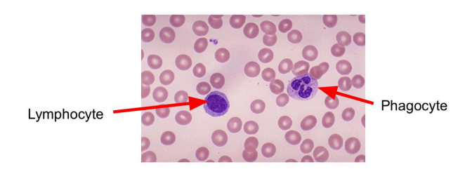 <p>lymphocytes have a smooth circle in their center</p>