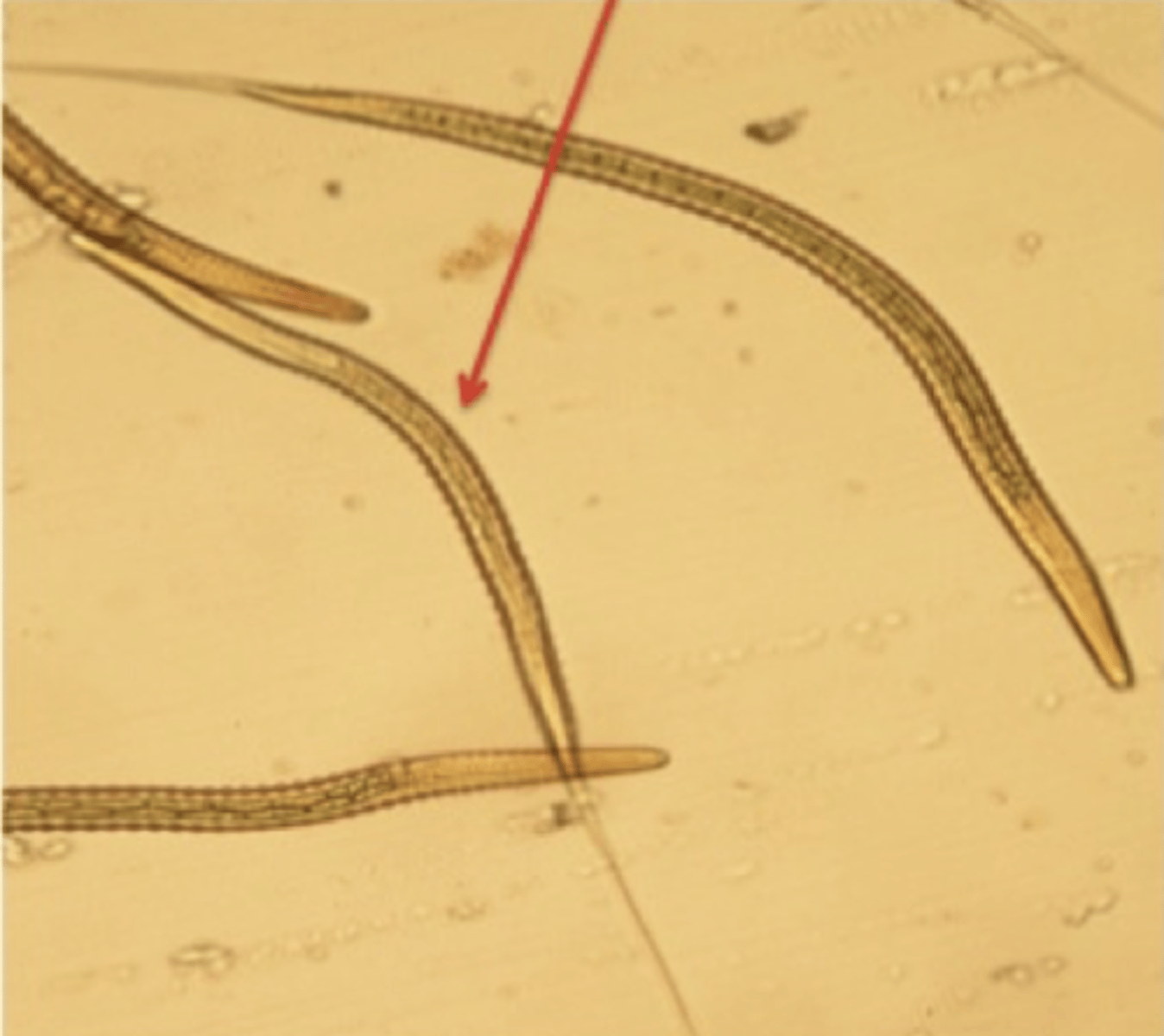 <p>Ved en larvedyrkning af fæces fra en hest, finder du denne larve. Hvad er det for en parasit larve?</p><p>- Strongylus edentatus</p><p>- Strongylus vulgaris</p><p>- Cyathostom larve</p><p>- Jord nematode</p>